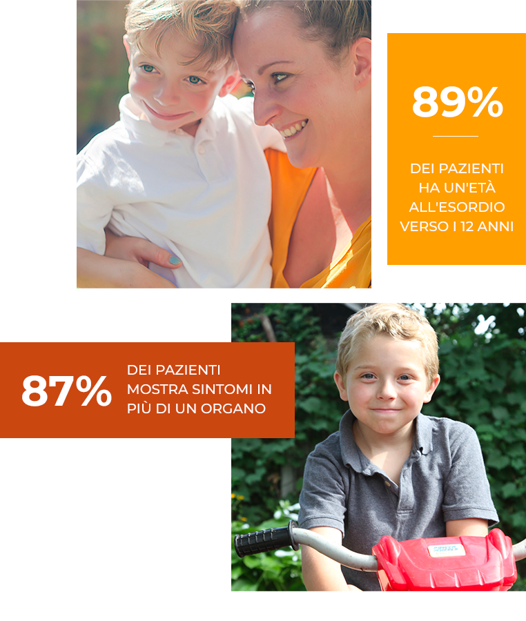 89% dei pazienti ha un'età all'esordio verso i 12 anni, 87% dei pazienti mostra sintomi in più di un organo