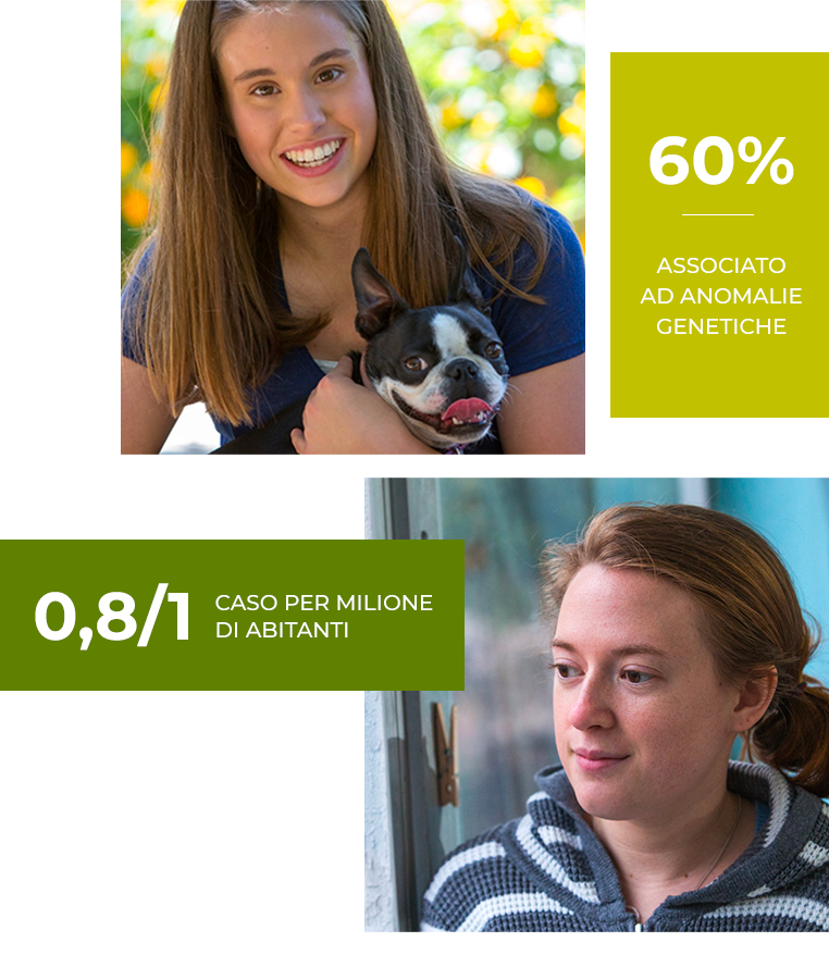 60% associato ad anomalie genetiche, 0.8/1 caso per milione di abitanti